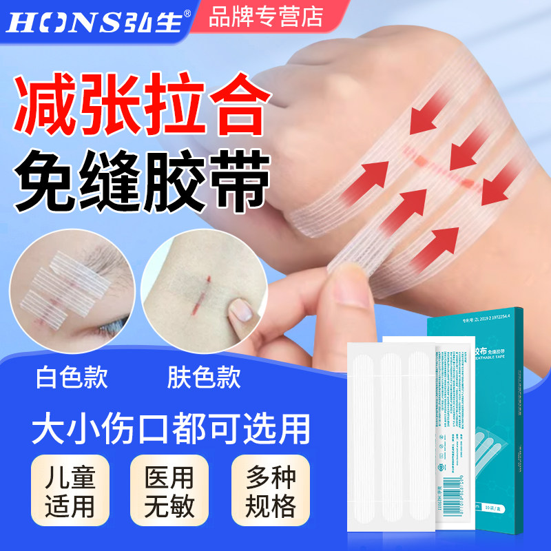 弘生免缝胶带医用儿童皮肤减张贴图片