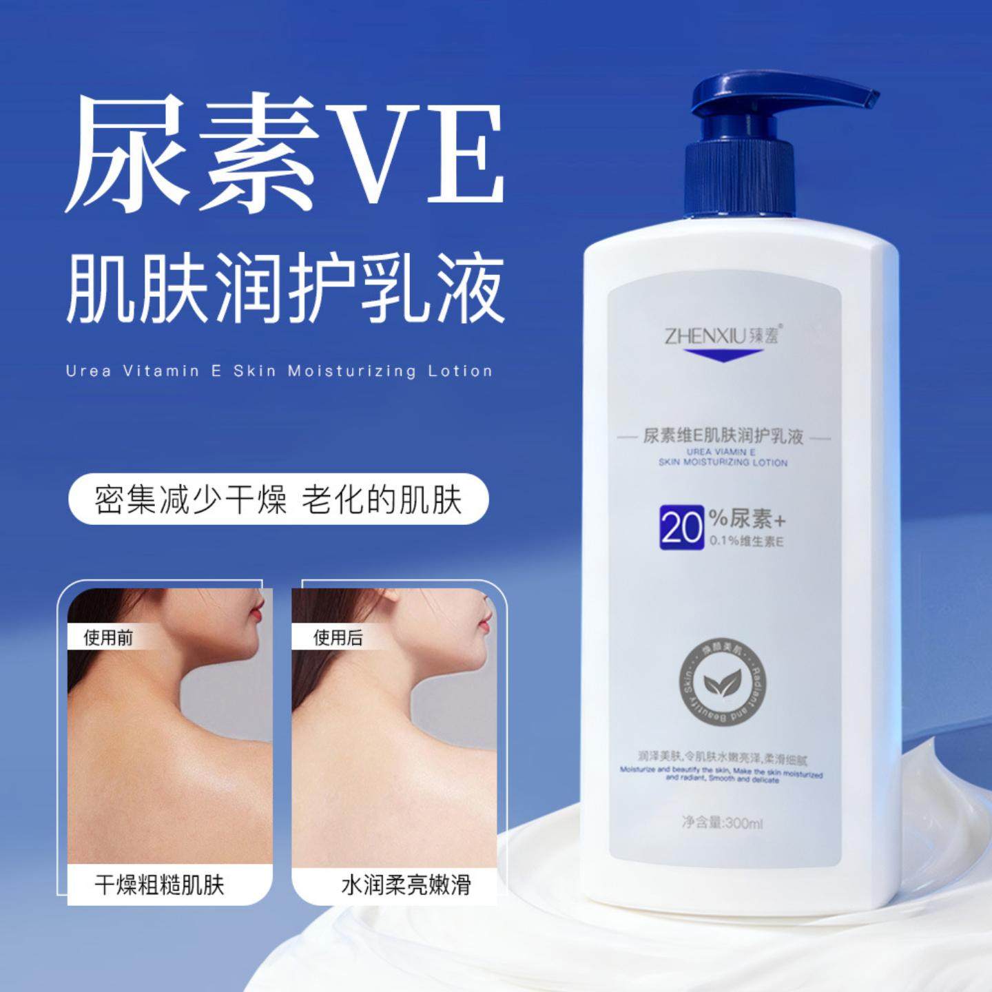 臻羞尿素维E肌肤润护乳液淡化鸡皮肤疙瘩改善皮肤干燥保湿身体乳