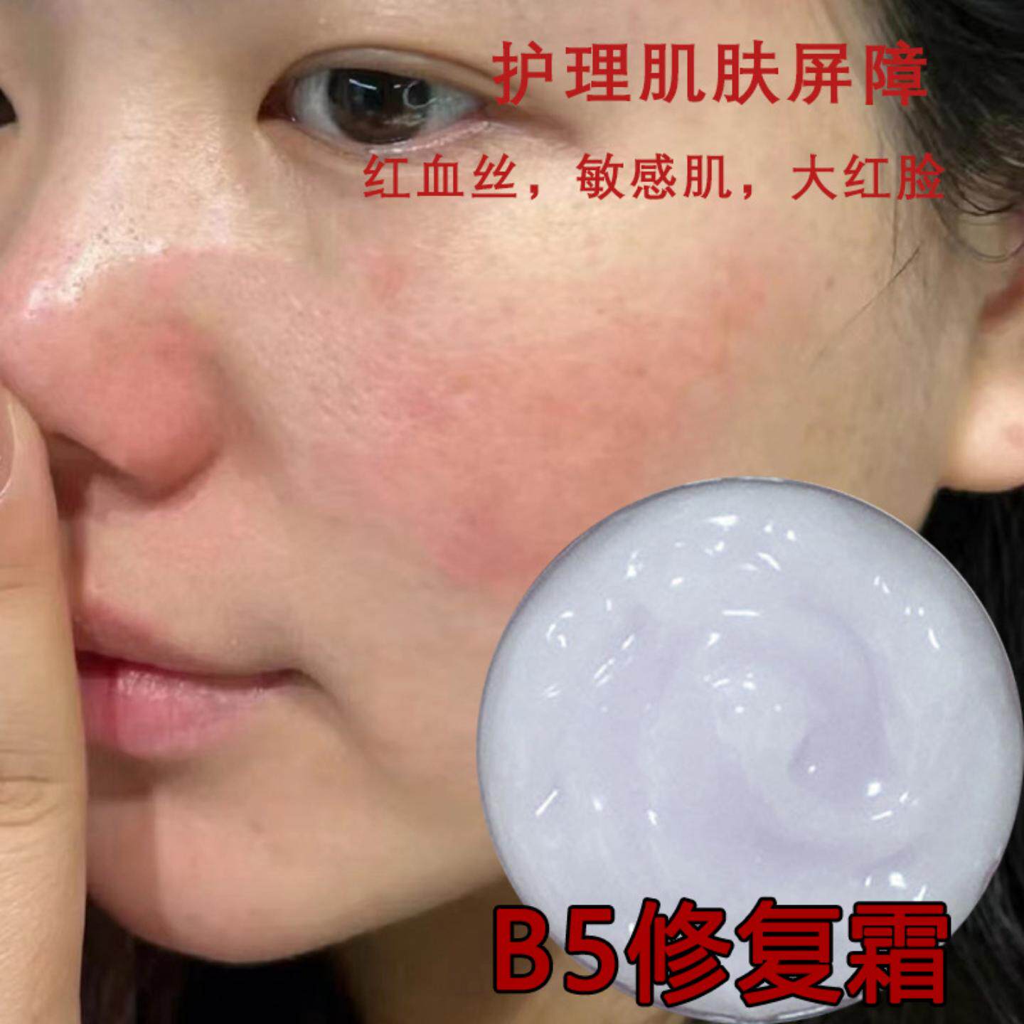b5修复霜修护霜去红血丝舒缓b5修复霜激素脸面霜泛红角质层美容院