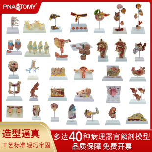 病理器官解剖模型肾子宫肝甲状腺大脑乳房骨质疏松膝关节腰椎教具