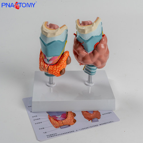 人体病理内分泌系统甲状腺模型