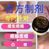 古方制剂疤克增生疤疤痕疙瘩凸疤膏色沉疤痕膏