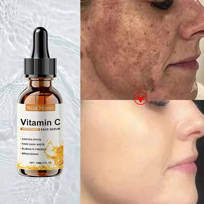 Vitamin C Whitening Serum Remove Freckles Dark Spots Face Es