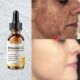Serum Vitamin Dark Whitening Freckles Face Remove Spots