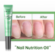Nutrition Polish Oil Nail Pen Soften Cuticle Revitalizer
