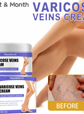 Intravenous Repair Cream Leg Curvature Earthworm Leg Leg Leg