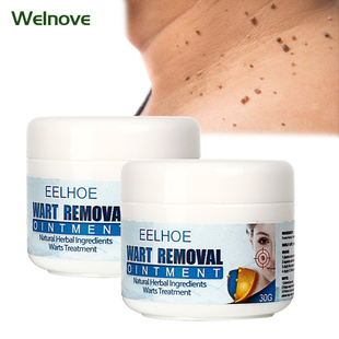 30g Skin Tag Remover Cream Warts Mole Remove Ointment Antiba