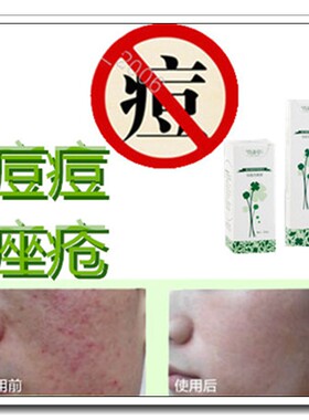 清洁封闭性粉刺祛后背青春痘痘印痤疮黑头导出液收缩毛孔急救神器