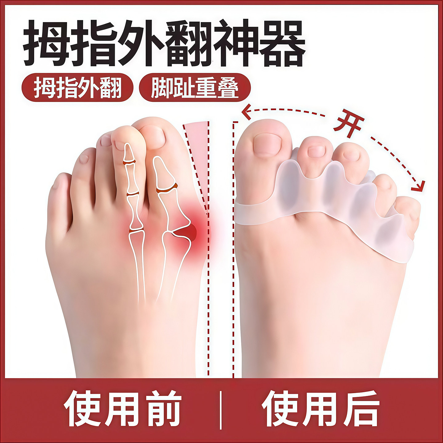 脚趾分趾矫正器外翻脚纠正神器