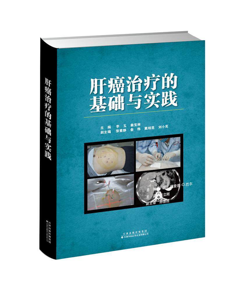 肝癌的基础与实践(精)李玉普通大众肝癌诊疗医药卫生书籍