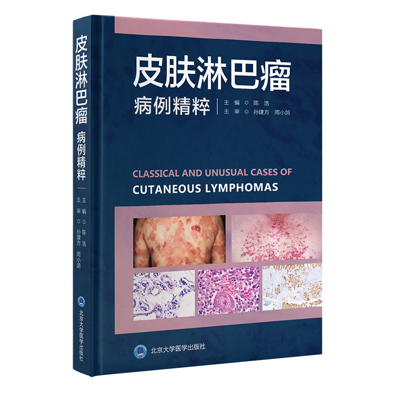 皮肤淋巴瘤病例精粹 陈浩 主编 全书囊括原发皮肤淋巴瘤的所有类型及临床病理亚型 系统淋巴瘤累及皮肤的病例及部分组织细胞病变