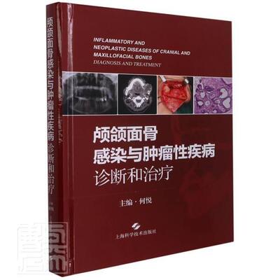颅颌面骨感染与疾病:诊断和:diagnosis and treatment何悦普通大众口腔颌面部疾病感染口腔颌面部疾医药卫生书籍