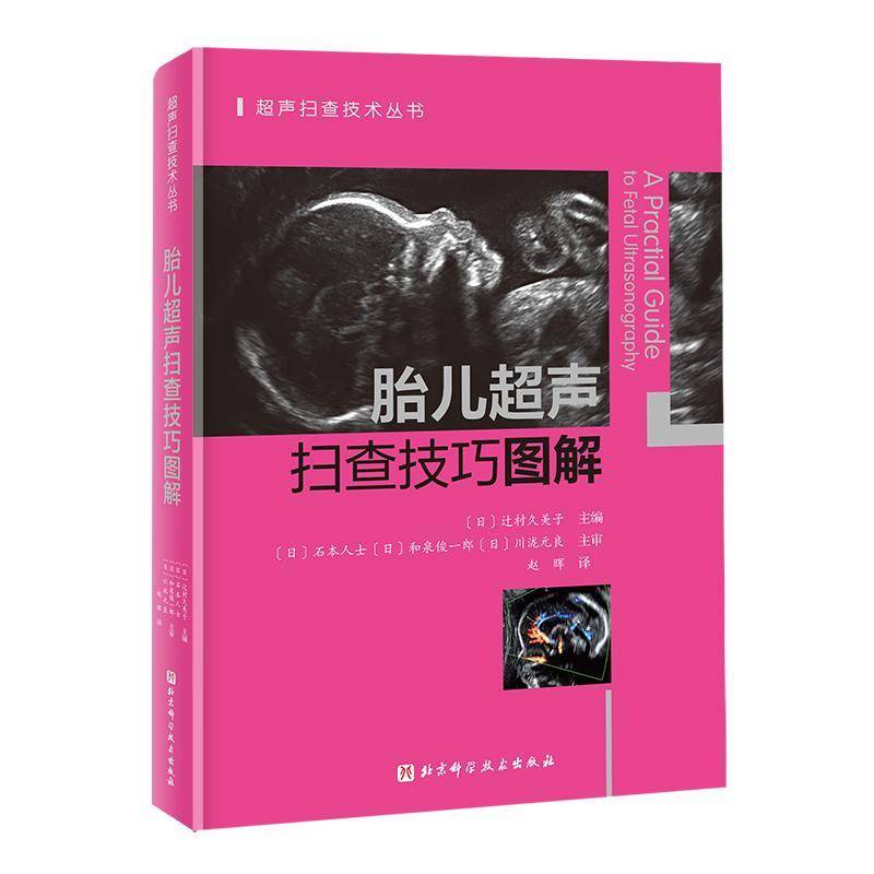 正版包邮 胎儿超声扫查技巧图解 一本书彻底搞懂胎儿心超扫查切面正常胎儿神经系统发育超声解剖图谱 北京科学技术出版社