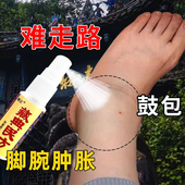 脚鼓包肿胀脚踝脚腕肿痛积液脚脖子走路用喷剂