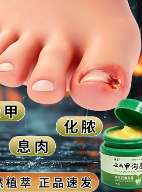 云南甲沟康修复趾指甲去息肉嵌甲甲板增厚指甲发黄空甲萎缩
