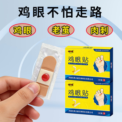 鸡眼贴脚底手足肉刺鸡眼脚垫老茧硬块专用贴温和自然