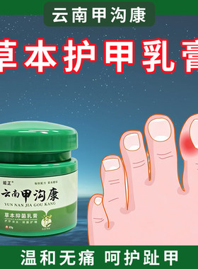 云南甲沟康修复趾指甲去息肉嵌甲甲板增厚指甲发黄空甲萎缩