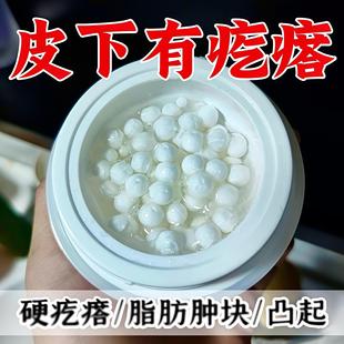 香港脂肪康正品肿块膏脂肪灵瘤膏皮下硬块鼓包多发性单发性涂抹膏