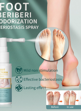 foot bacteria bacteriostasis spray deodorization remove