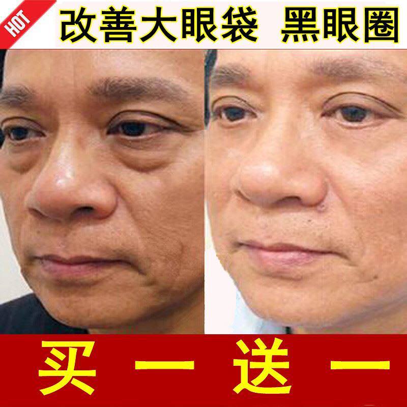 同仁堂眼霜眼袋神器快速改善黑眼圈大眼袋浮肿中老年男士专用去除
