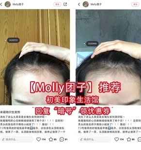 Molly团子姐姐推荐 KL发际线头发密发增密专属链接 小红书