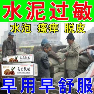 水泥过敏痒外用皮肤过敏手痒脱皮大腿后背脱皮干裂开裂油漆过敏膏