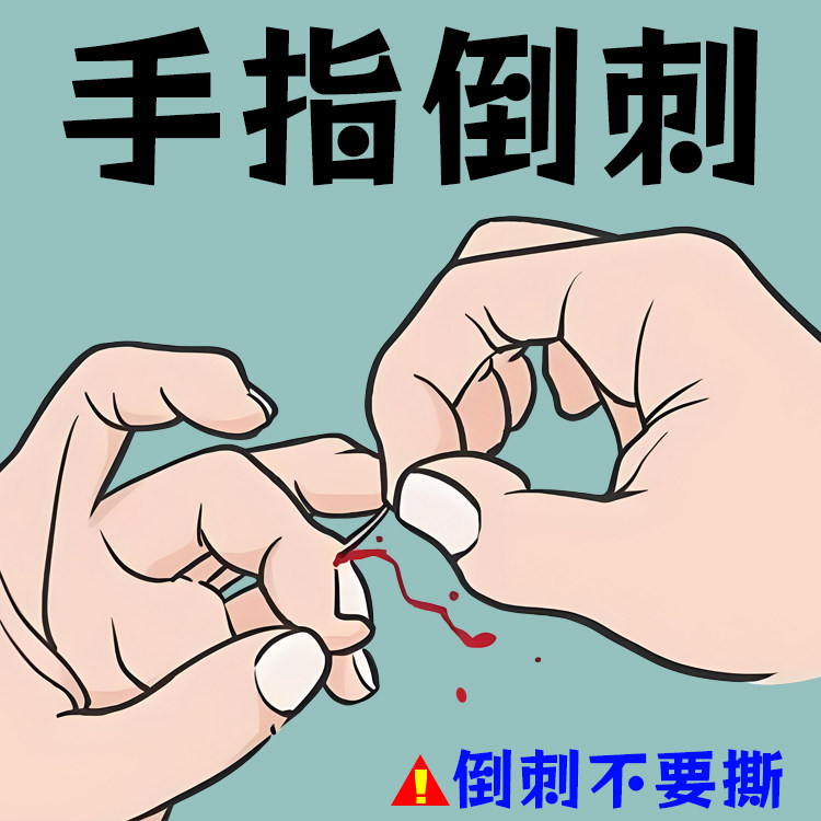 手指倒刺手足脱皮膏起皮指甲边缘干裂脱屑儿童手上长肉刺防倒刺