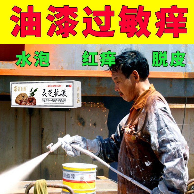 油漆过敏皮肤红肿瘙痒脱皮疙瘩手足裂口止痒膏涂料水泥接触性过敏