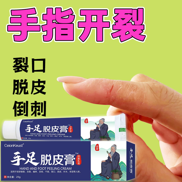 手指开裂修复儿童指甲边缘干裂手上长肉刺防倒刺手足脱皮膏