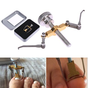 Ingrown Toenails Toe Nail Care Tool Professional