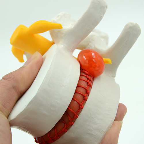 人体腰椎间盘挤压模拟演示模型放大脊椎脊柱病变正骨教学