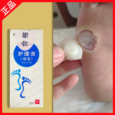 美甯儿涂抹鸡茧脚垫液