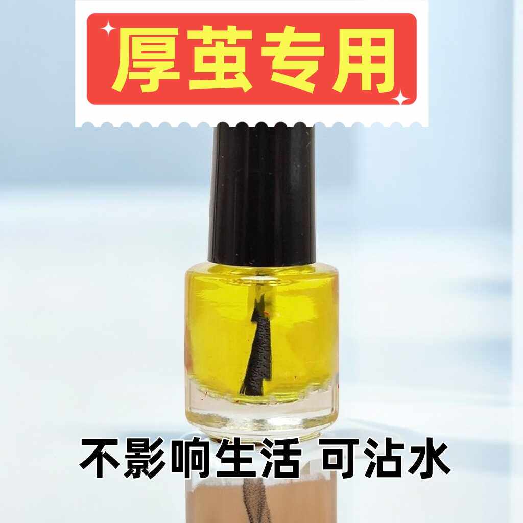 老茧液涂抹去老茧脚垫肉刺涂抹操作便捷神器