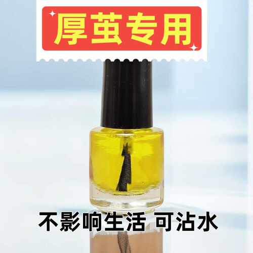 老茧涂抹液去脚垫美甯儿足部护理