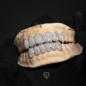 金牙套 定制牙套 hiphop牙套 满钻牙套 WBJ定制珠宝