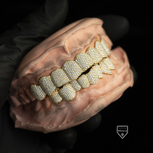 WBJ定制珠宝定制欣赏牙套金牙套钻石牙套grillz各种材质K金+钻石