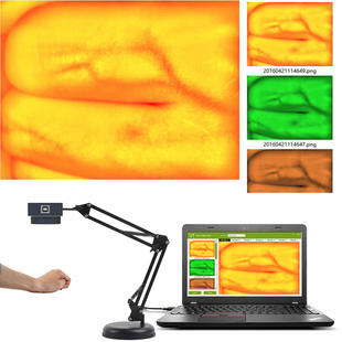 ZY620 Vein Viewer Blood Vessel Finder for IV  Veinfinder