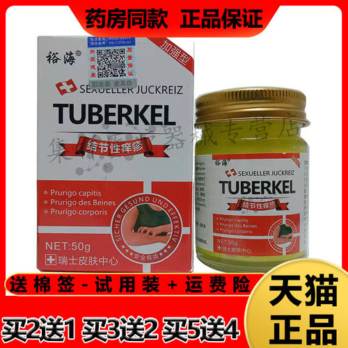 裕海结节性痒疹肛门大腿瘙痒