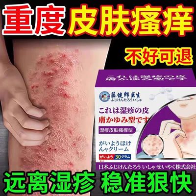 疹湿止痒根去外用顽固皮炎除湿皮肤瘙痒氟芬那酸丁酯软膏20g布特G