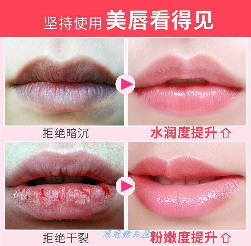 干燥。30片护唇膜嘴唇面膜补水保湿去死皮防品牌嘴膜贴唇部护理唇