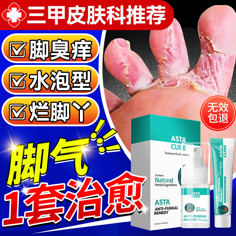 【自营】脚气止痒脱皮杀菌去根专用特效药脚痒水泡烂脚丫喷雾真菌