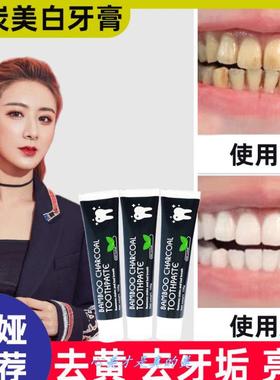 竹炭黑色牙膏男士去牙黄牙垢牙结石除口臭清除口气女.