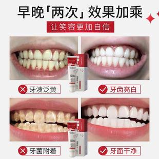 去牙膏黄去黑口臭美白牙齿黑斑去除渍LIN牙垢速效牙根发益生牙菌