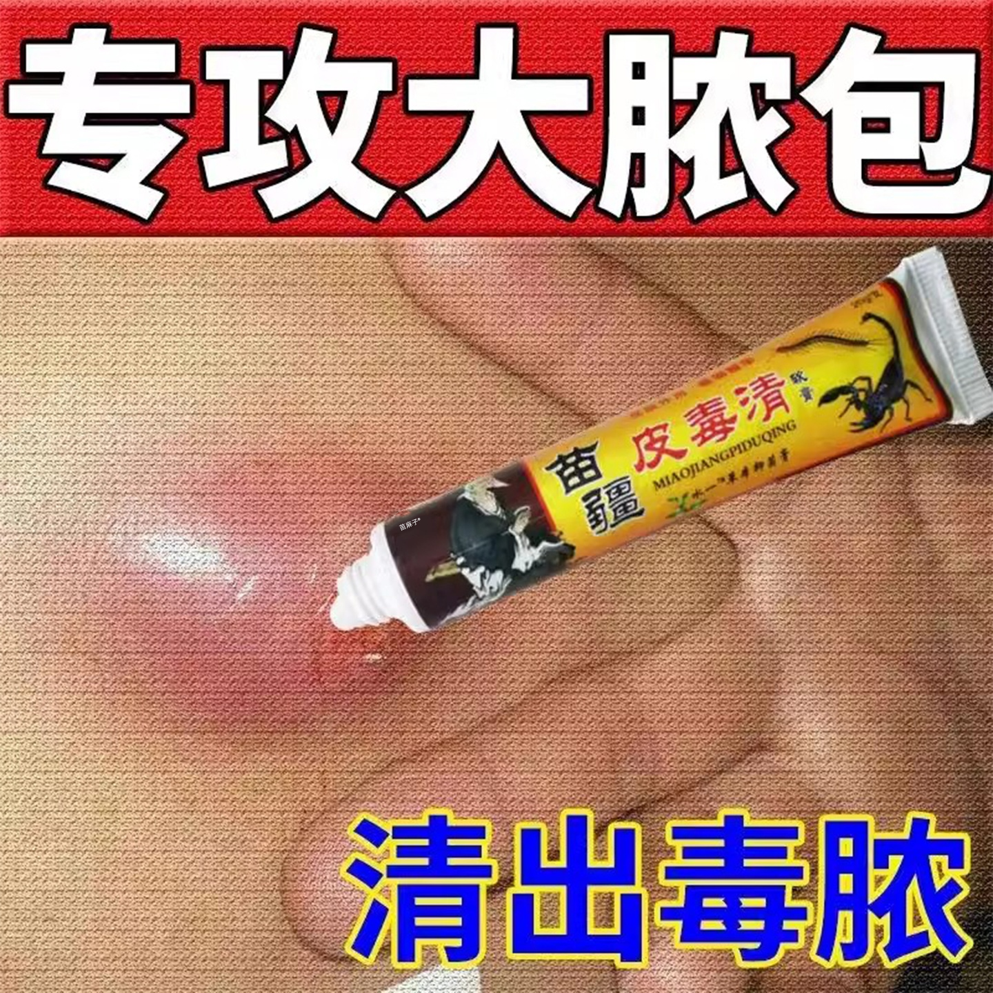 火疖子拔毒拔脓止痒药膏脓包硬块皮脂腺囊肿屁股坐板疮脂肪敷料贴