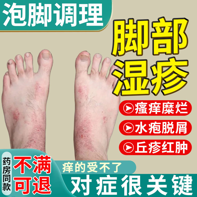【湿疹止痒杀菌】足部专用泡脚粉