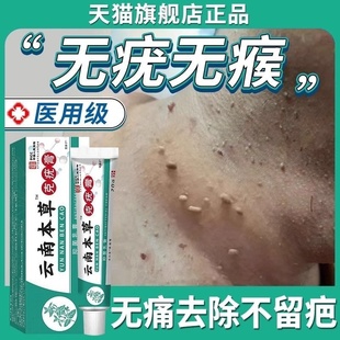 云南本草克疣膏去疣药膏水尤瘊子小肉粒扁平去除膏一抹灵斩草除根