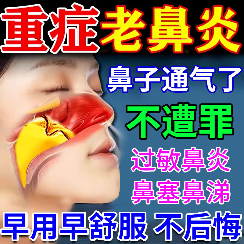 日本鼻炎贴儿童过敏性鼻窦炎贴膏