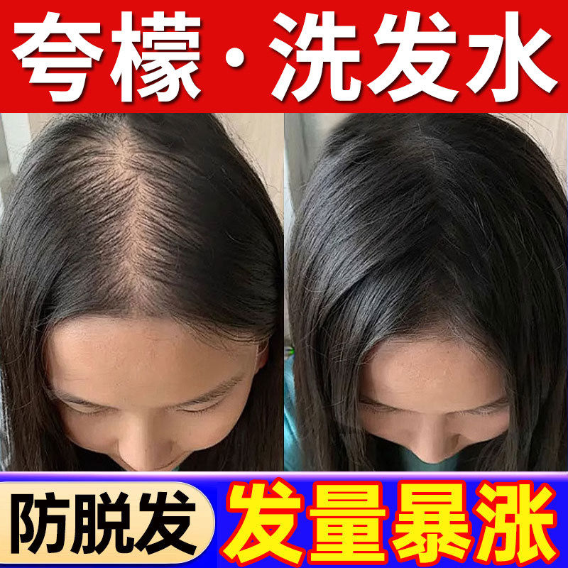 夸蒙洗发水控油蓬松去屑止痒防脱育发防断发男女檬正品官方店