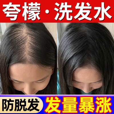 夸檬洗发水控油蓬松去屑