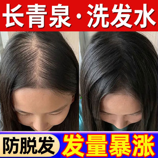 长青泉洗发水防脱育发液增密控油蓬松洗发液长清泉官方店正品